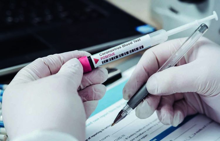 Oms annuncia: «Prototipo vaccino anti Covid entro fine anno»