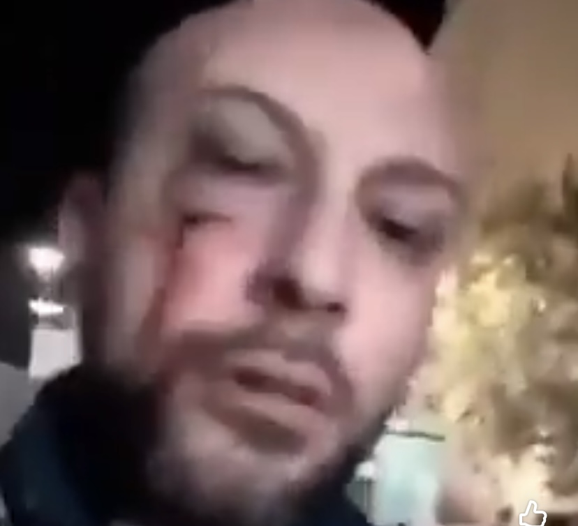 Il primato positivo di Eav, le aggressioni su treni e stazioni Circum sono ancora in calo