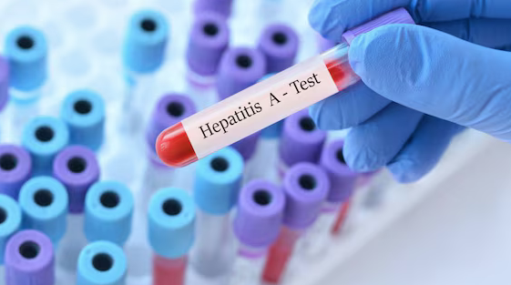 Emergenza Epatite A, Assoambulanti a Fico: «Ristoratori per i venditori del settore ittico»