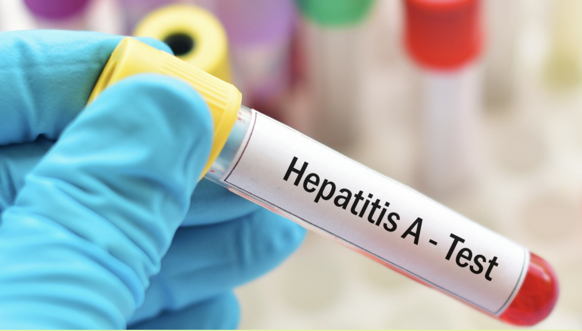 Epatite A, il decalogo della prevenzione: dalla tavola ai vaccini le armi per fermare il contagio